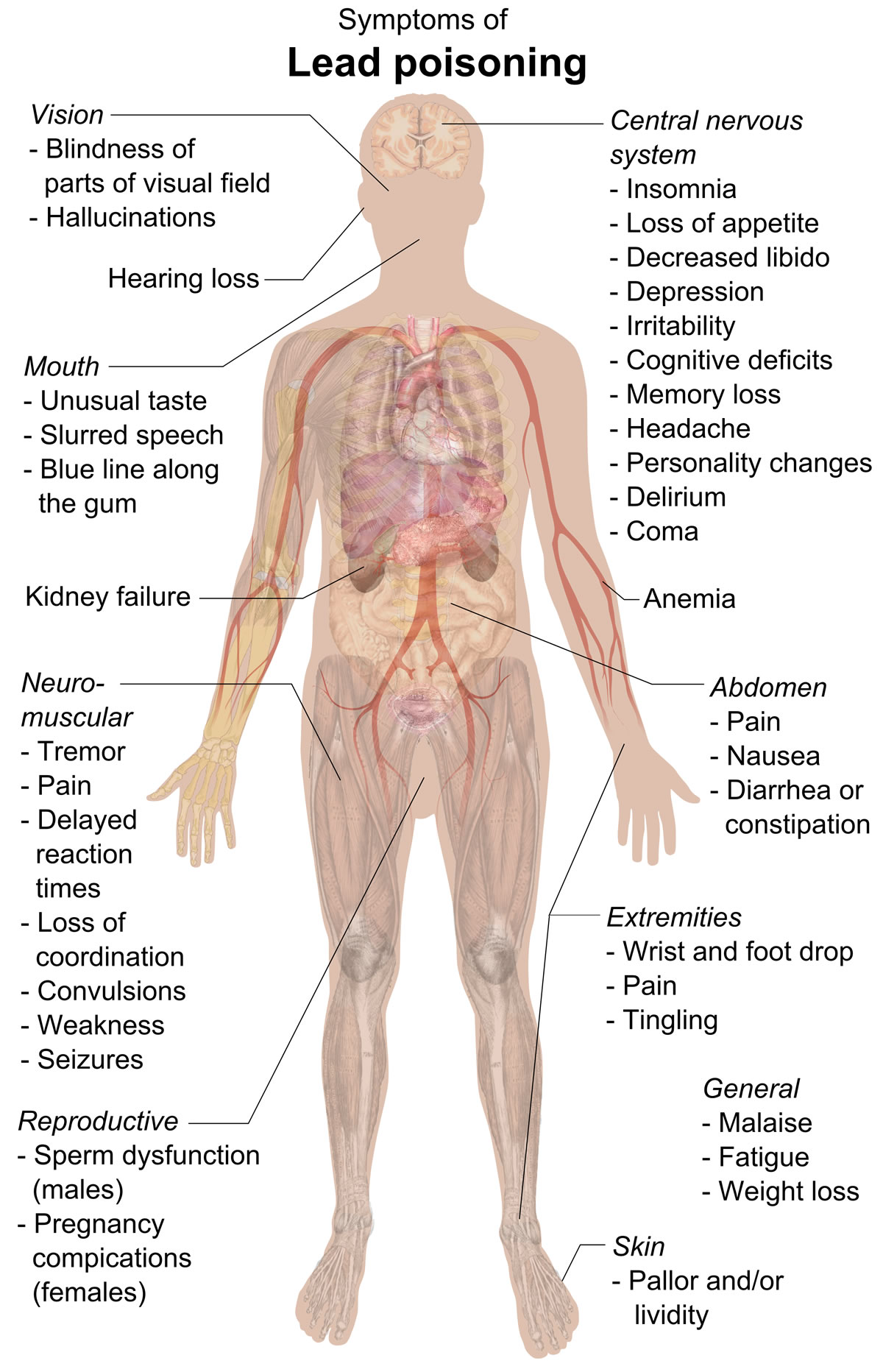 The Danger Posed To Humans By Lead Contamination SanAir Technologies 