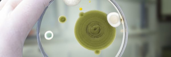 Colonies Of Different Mold Fungi Grown From Indoor Air On Petri