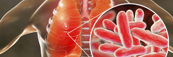 Legionella Pneumophila Bacteria